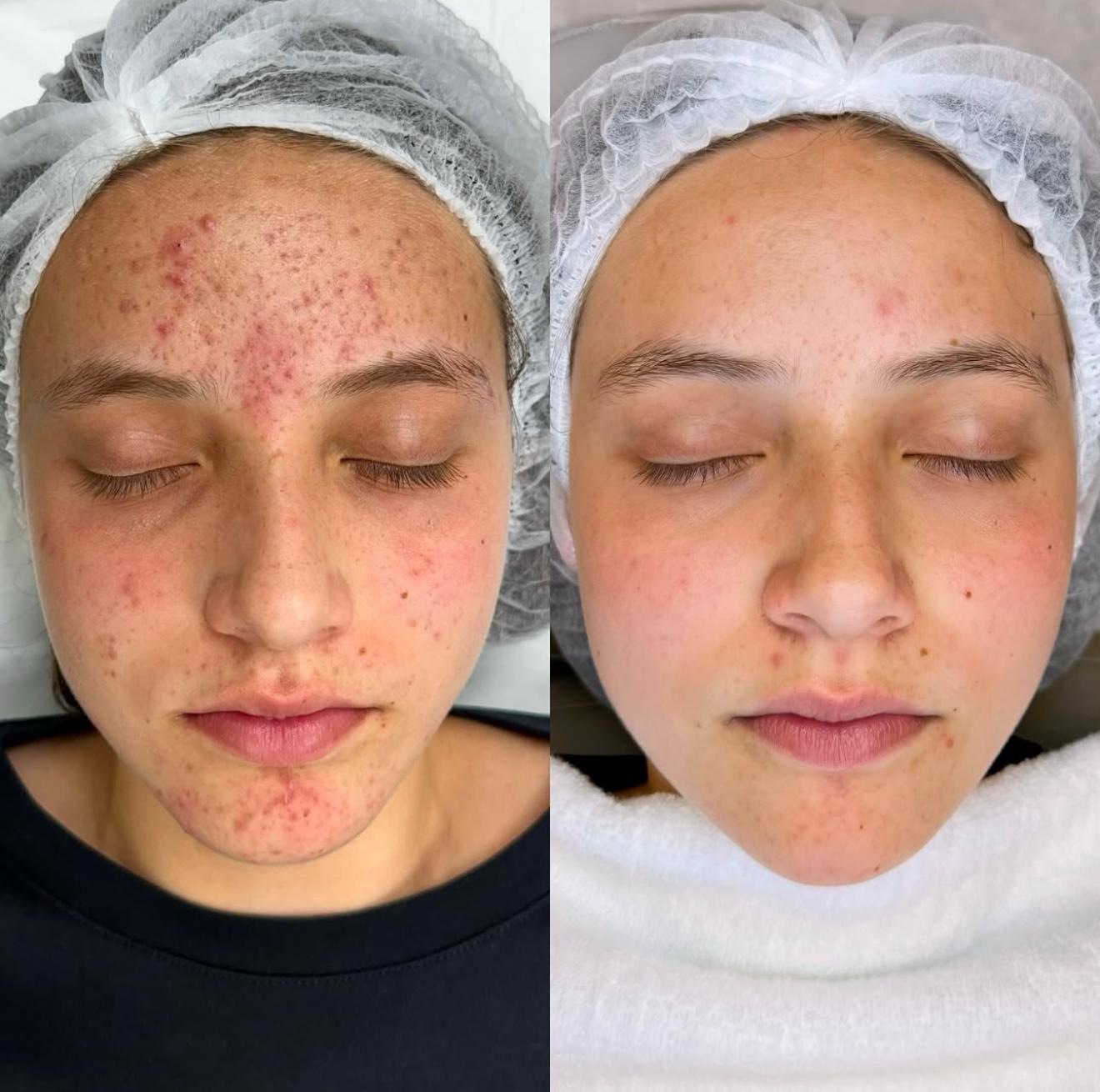 WhatsApp Image 2025-03-19 at 20.57.52